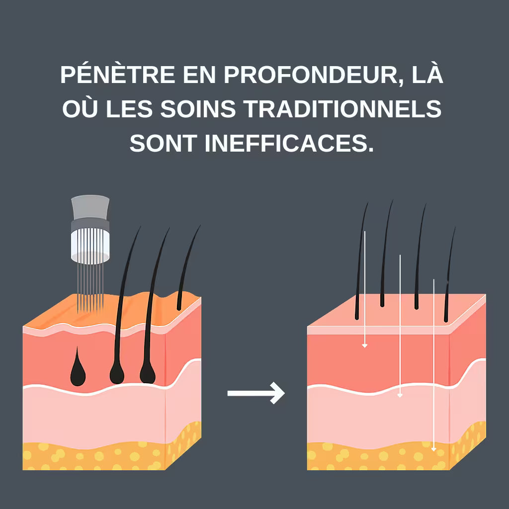 Micro Infusion Réparation & Repousse + Sérum extra offert