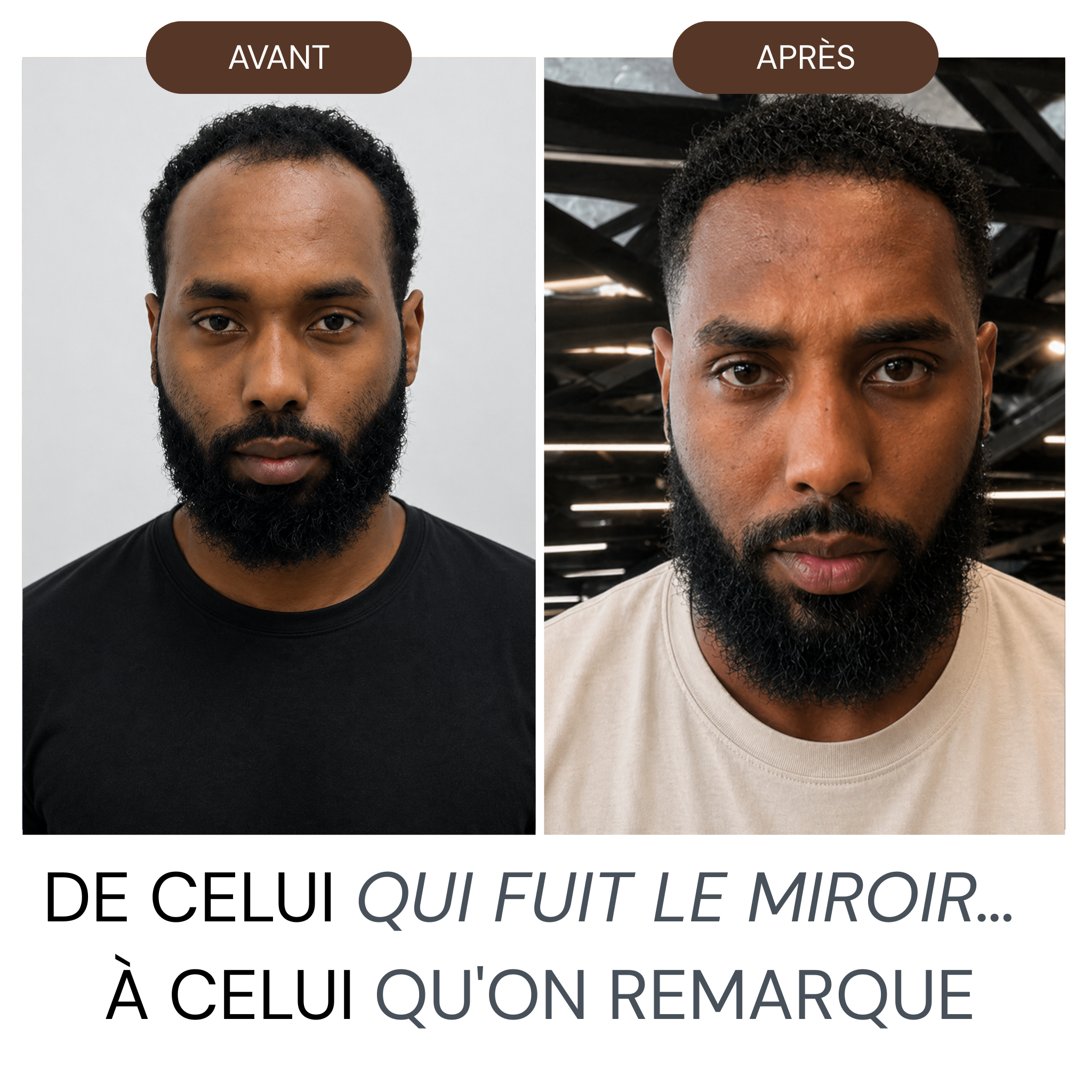 Micro Infusion Hommes Réparation & Repousses Afro + Sérum extra offert
