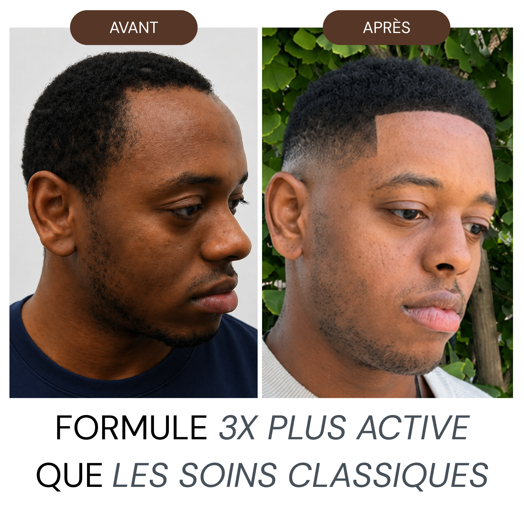Micro Infusion Hommes Réparation & Repousses Afro + Sérum extra offert