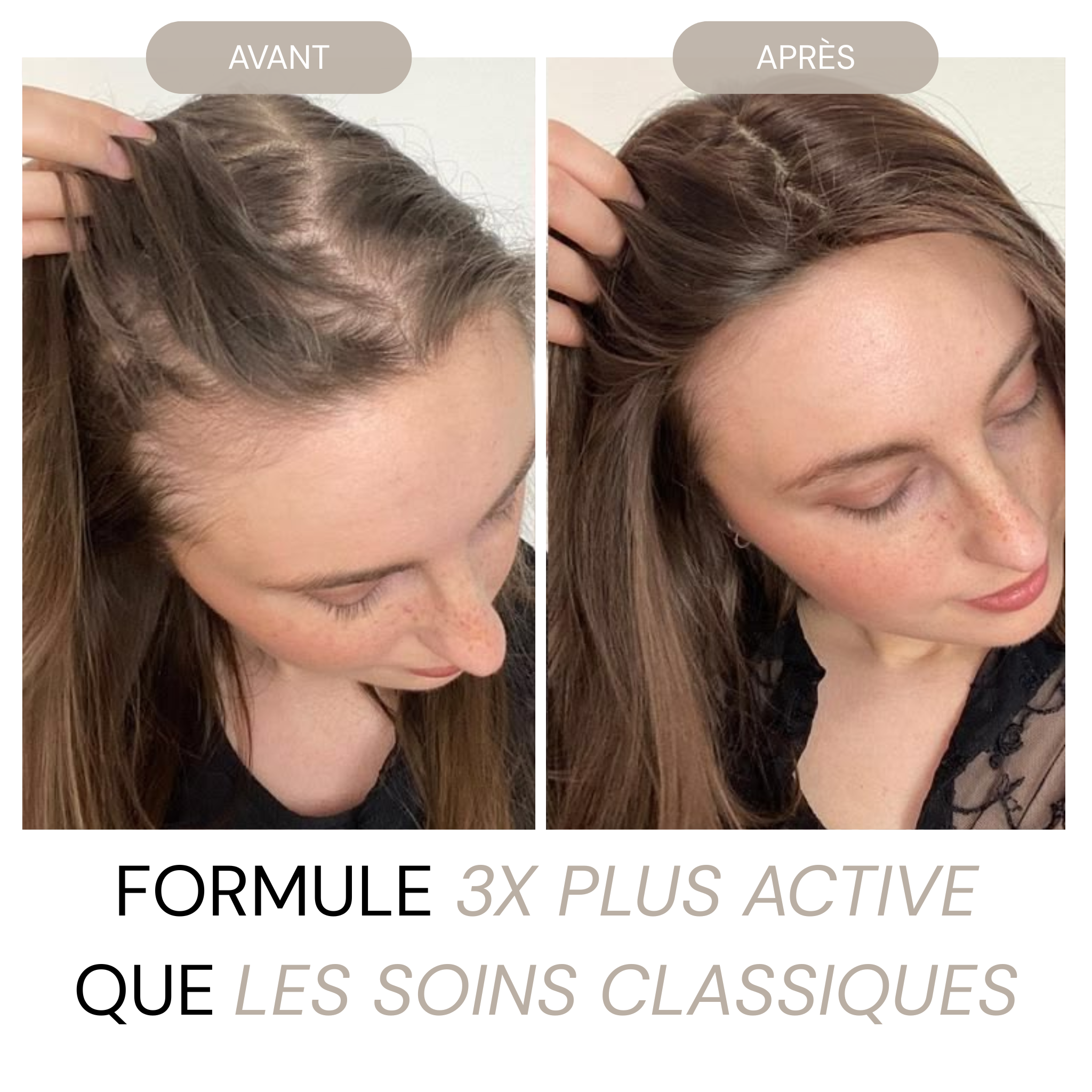 Micro Infusion Réparation & Repousses + Sérum extra offert