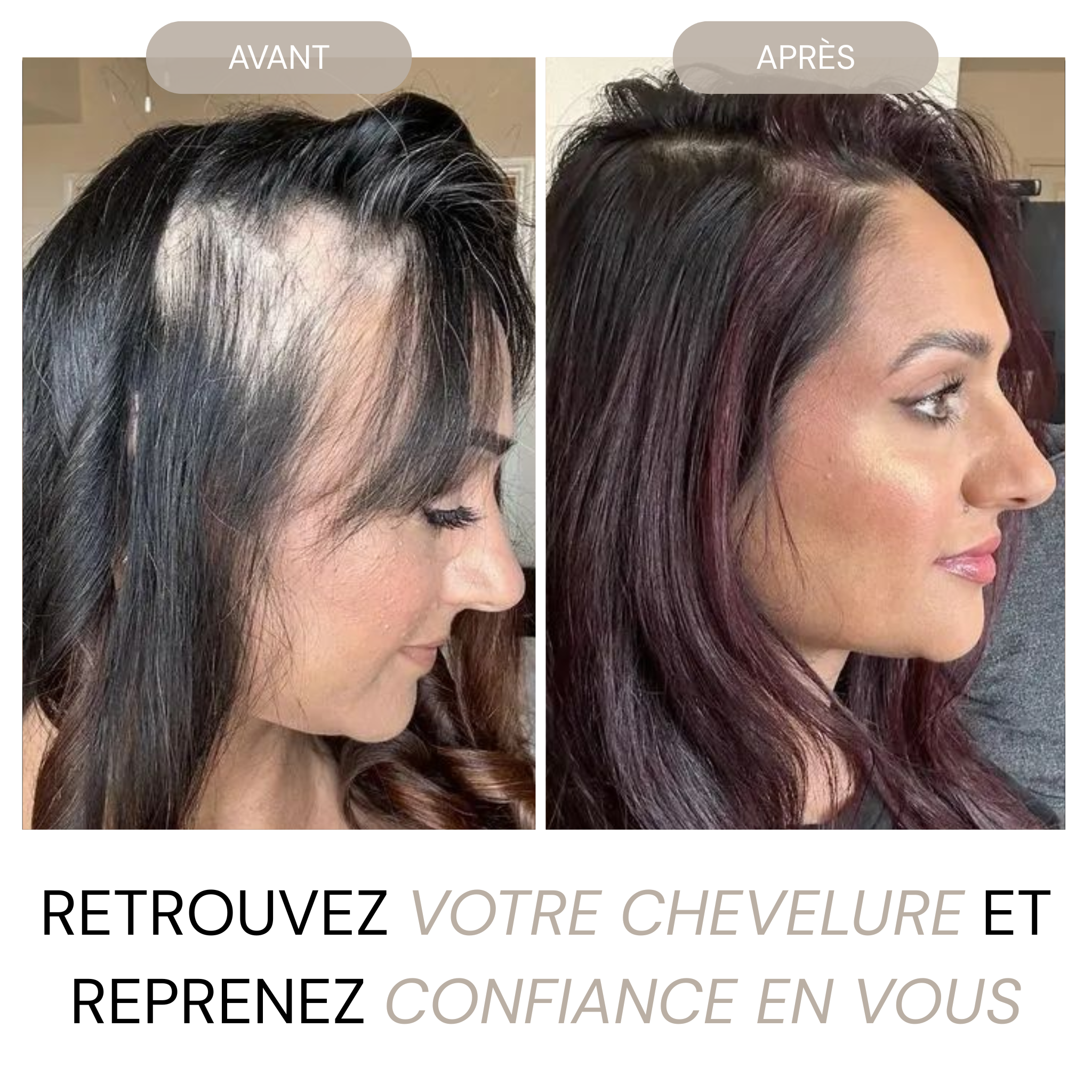 Micro Infusion Réparation & Repousses + Sérum extra offert