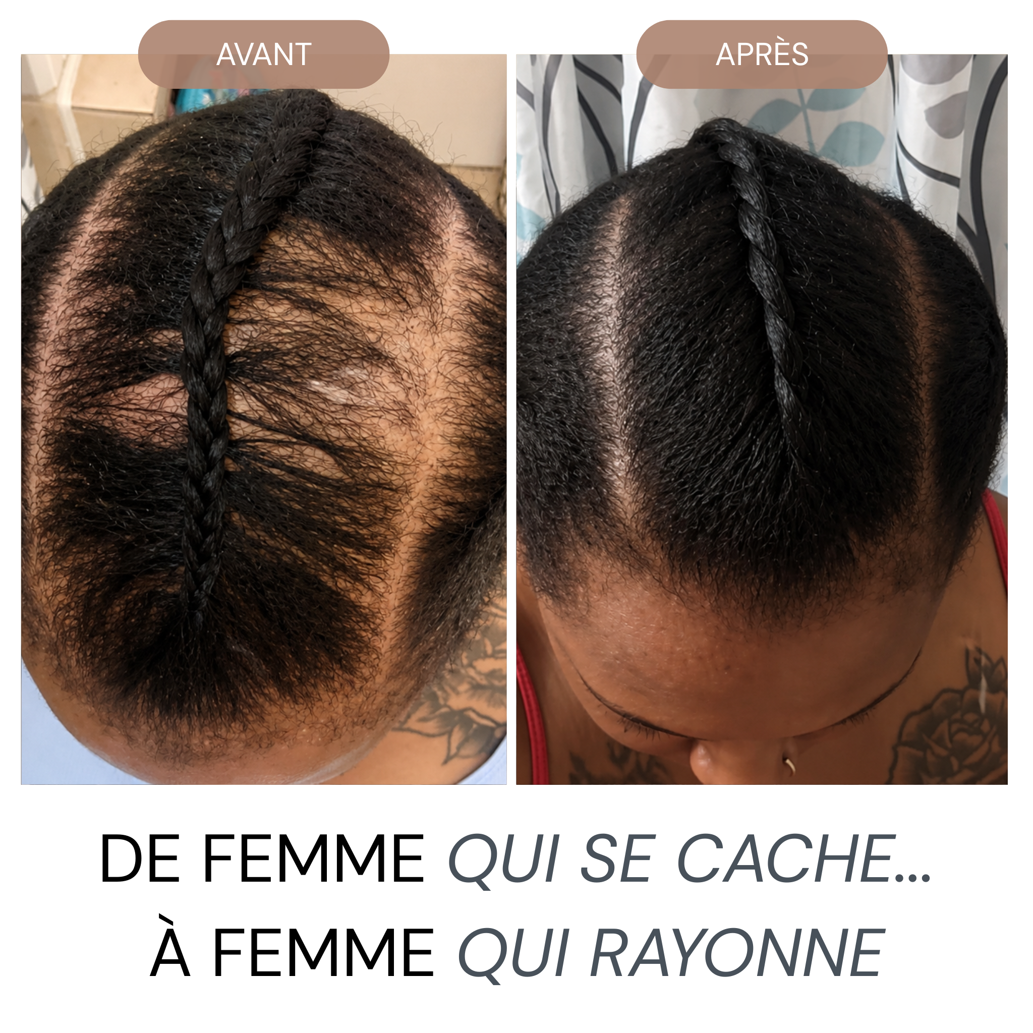 Micro Infusion Réparation & Repousses Afro  + Sérum extra offert
