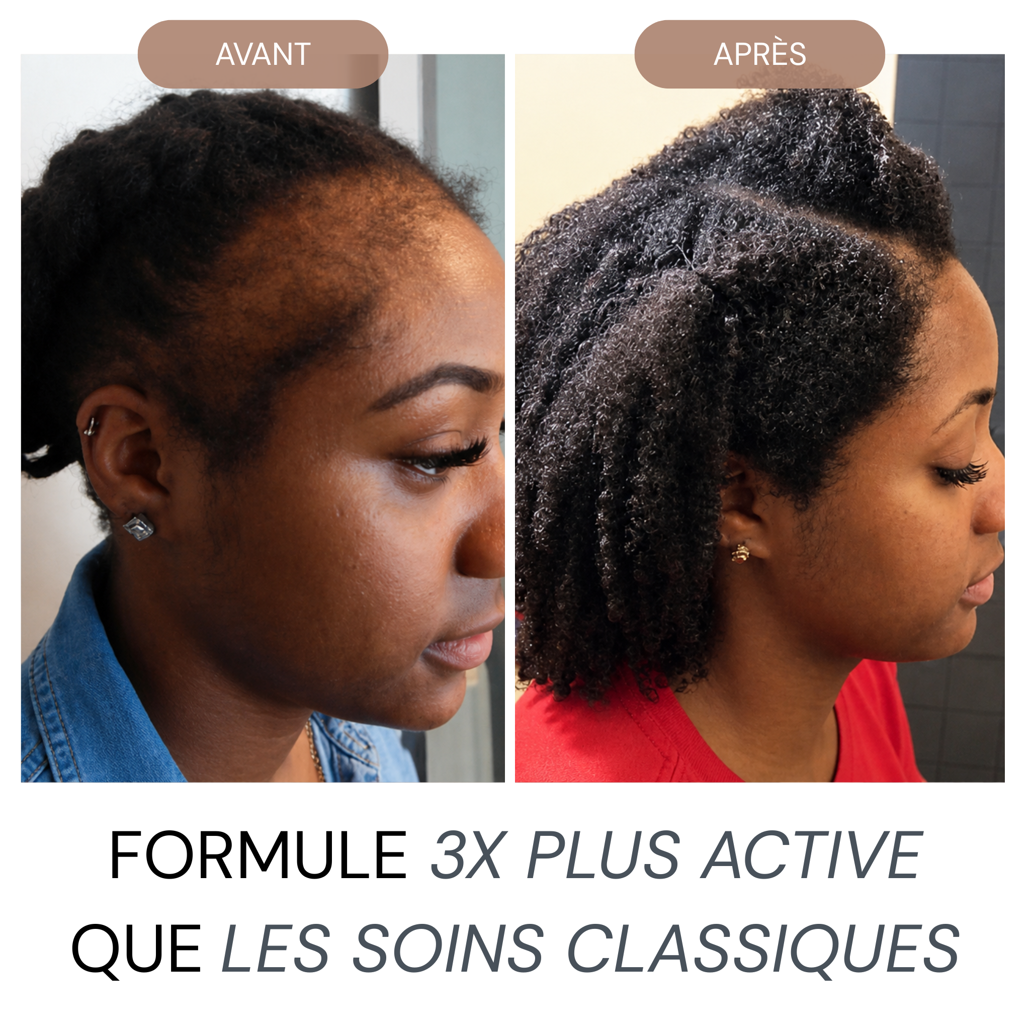 Micro Infusion Réparation & Repousses Afro  + Sérum extra offert