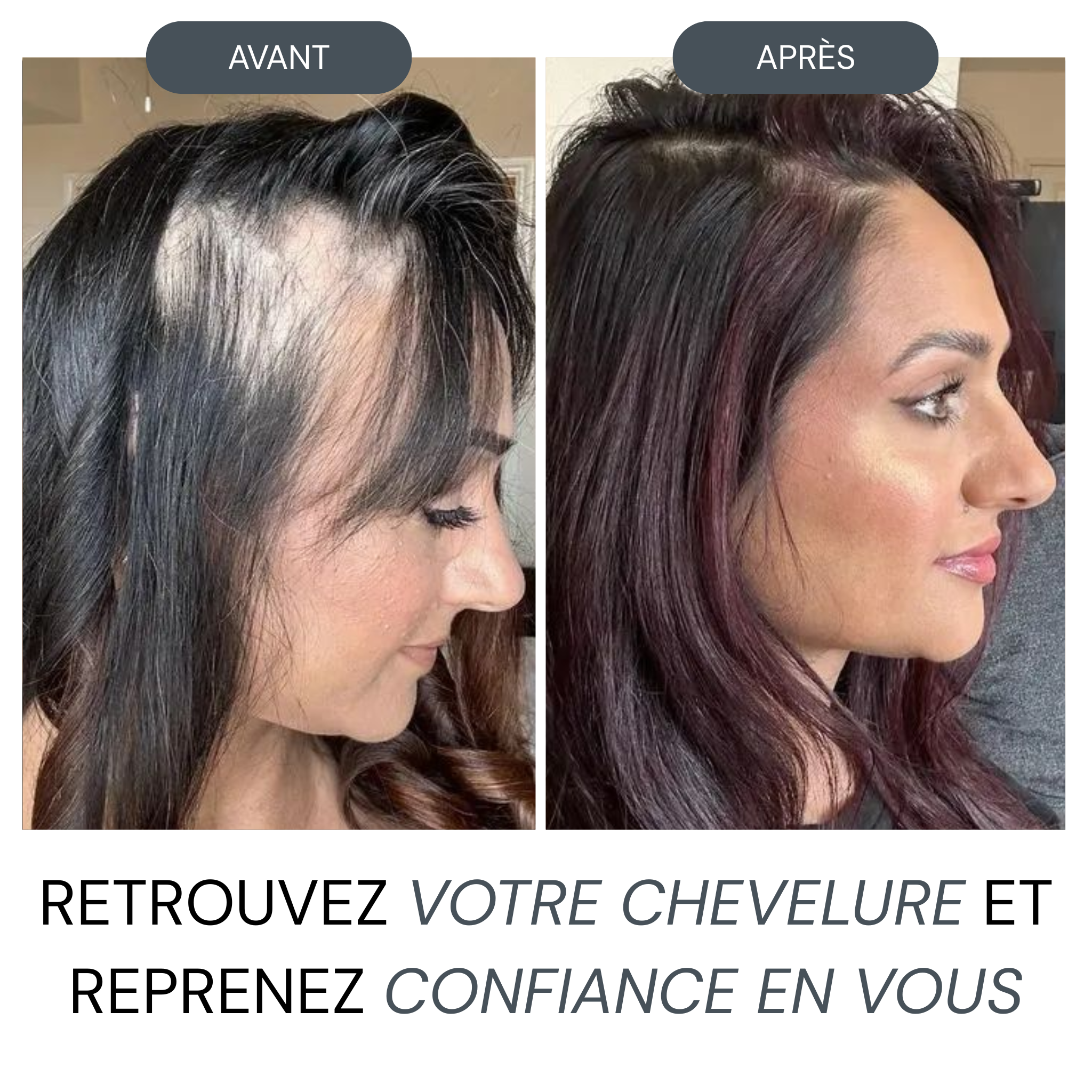Micro Infusion Réparation & Repousse + Sérum extra offert