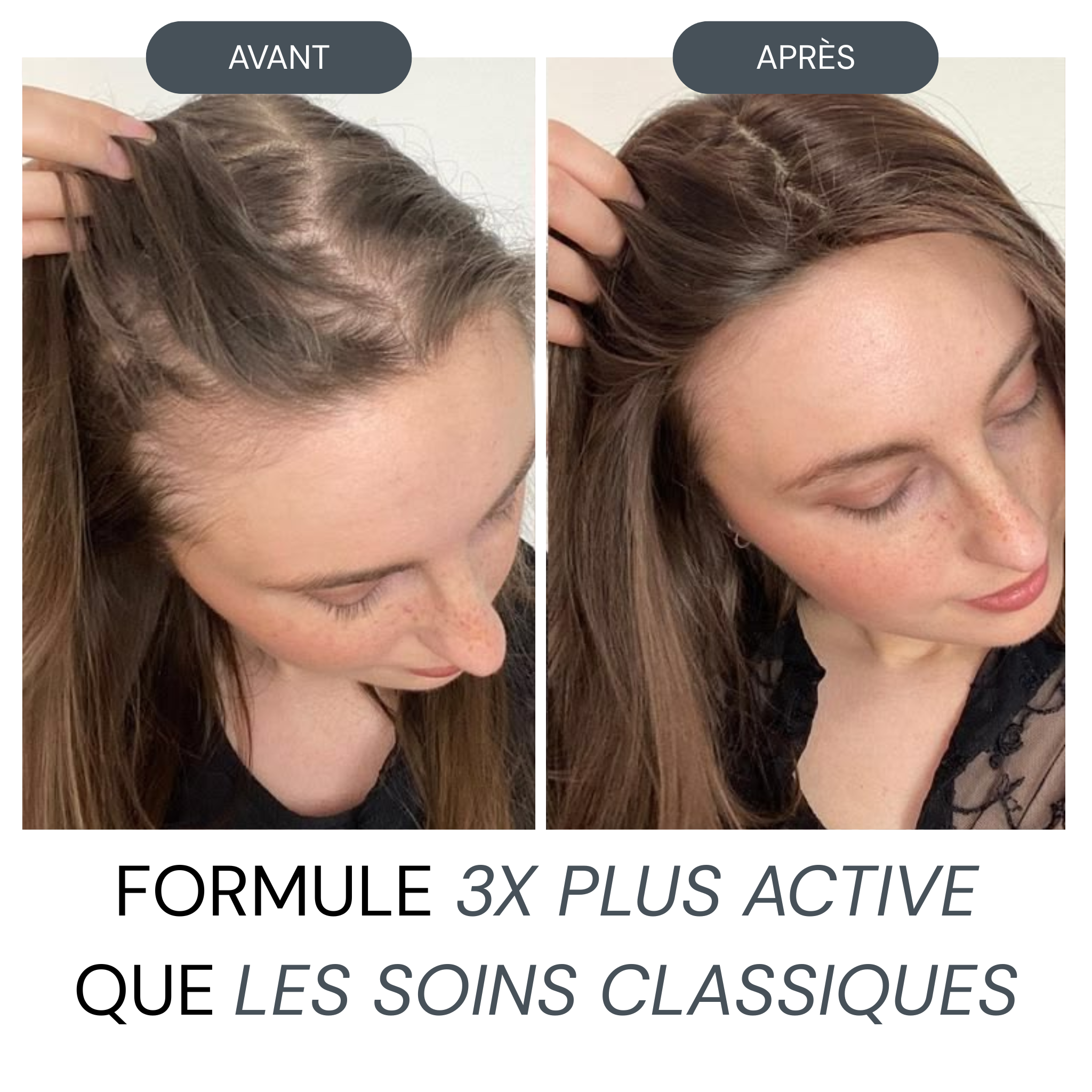 Micro Infusion Réparation & Repousse + Sérum extra offert