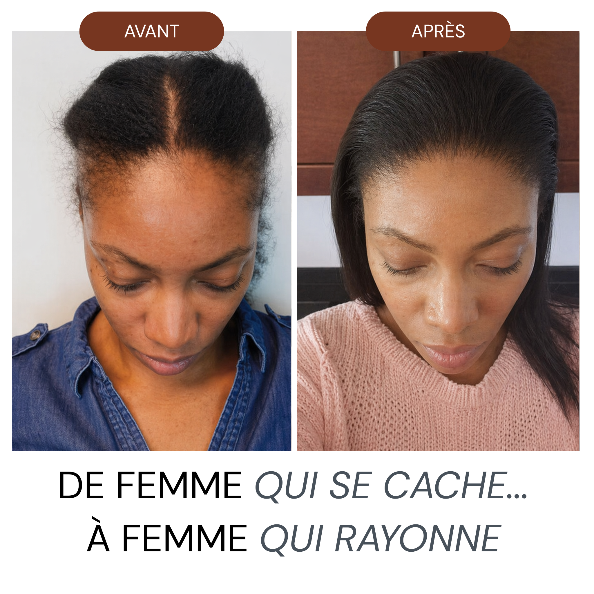 Micro Infusion Réparation & Repousses Afro + Sérum extra offert