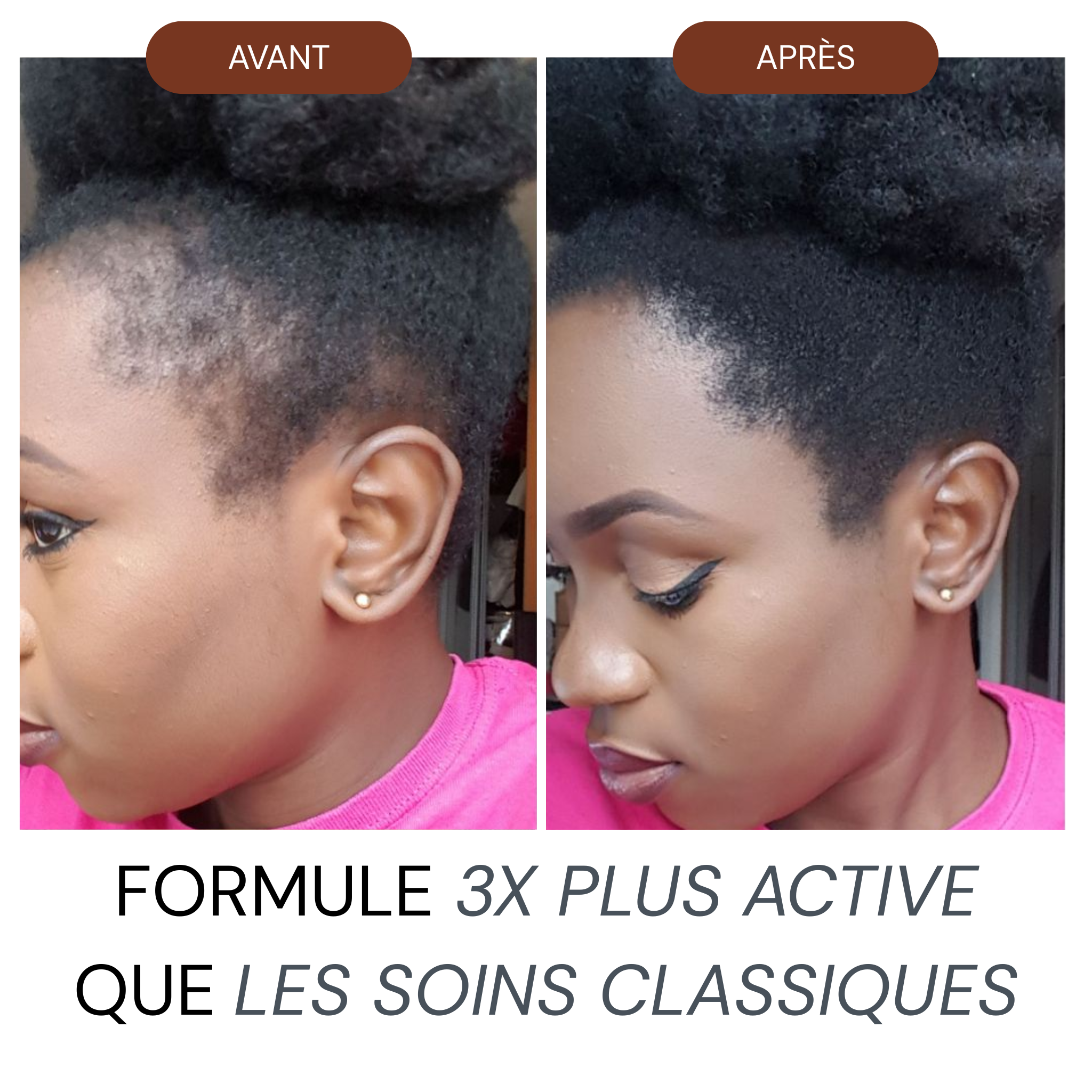 Micro Infusion Réparation & Repousses Afro + Sérum extra offert