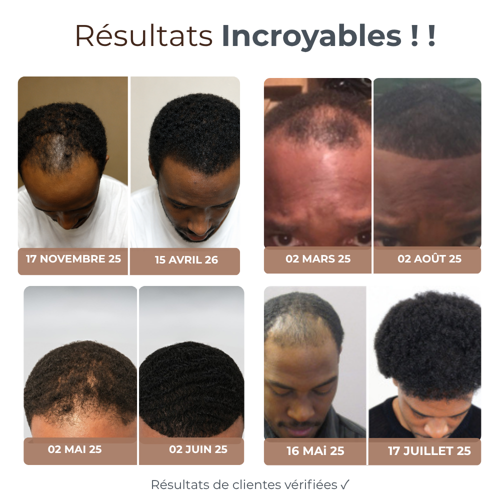 Micro Infusion Hommes Réparation & Repousses Afro + Sérum extra offert