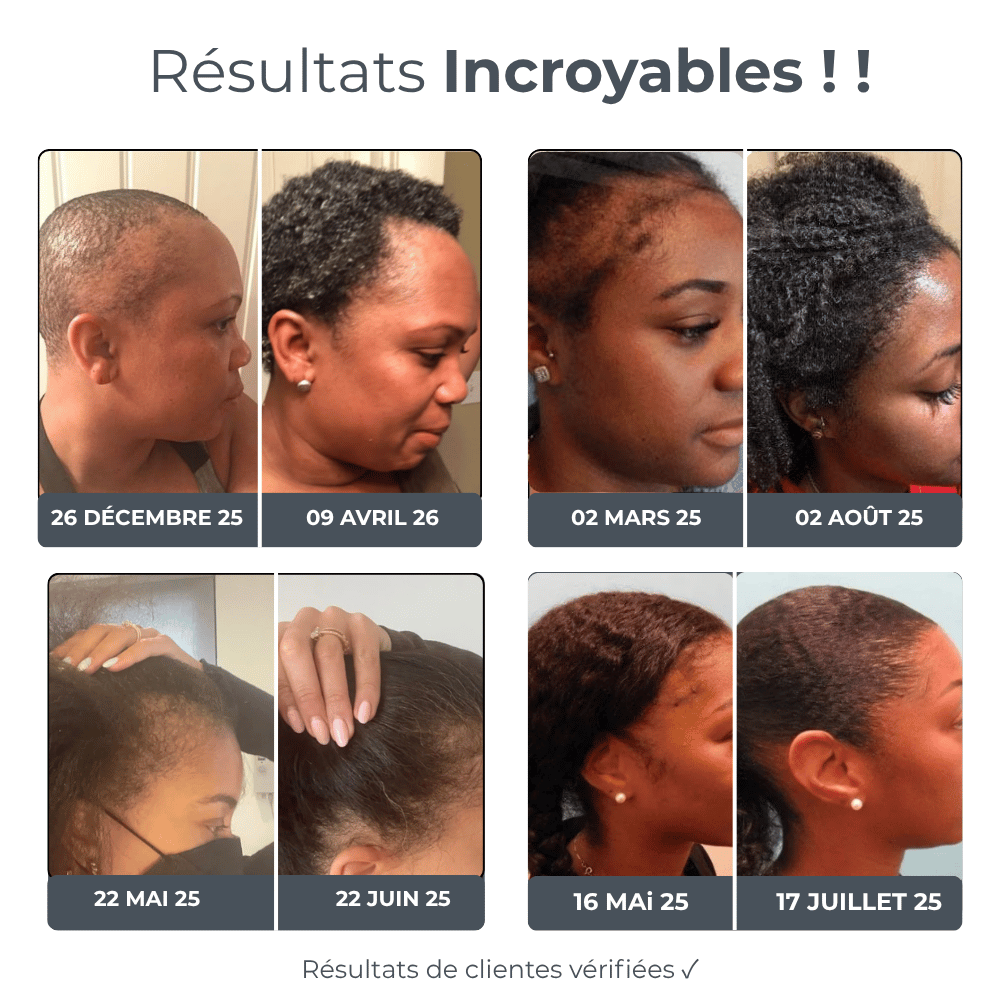 Micro Infusion Réparation & Repousses Afro + Sérum extra offert