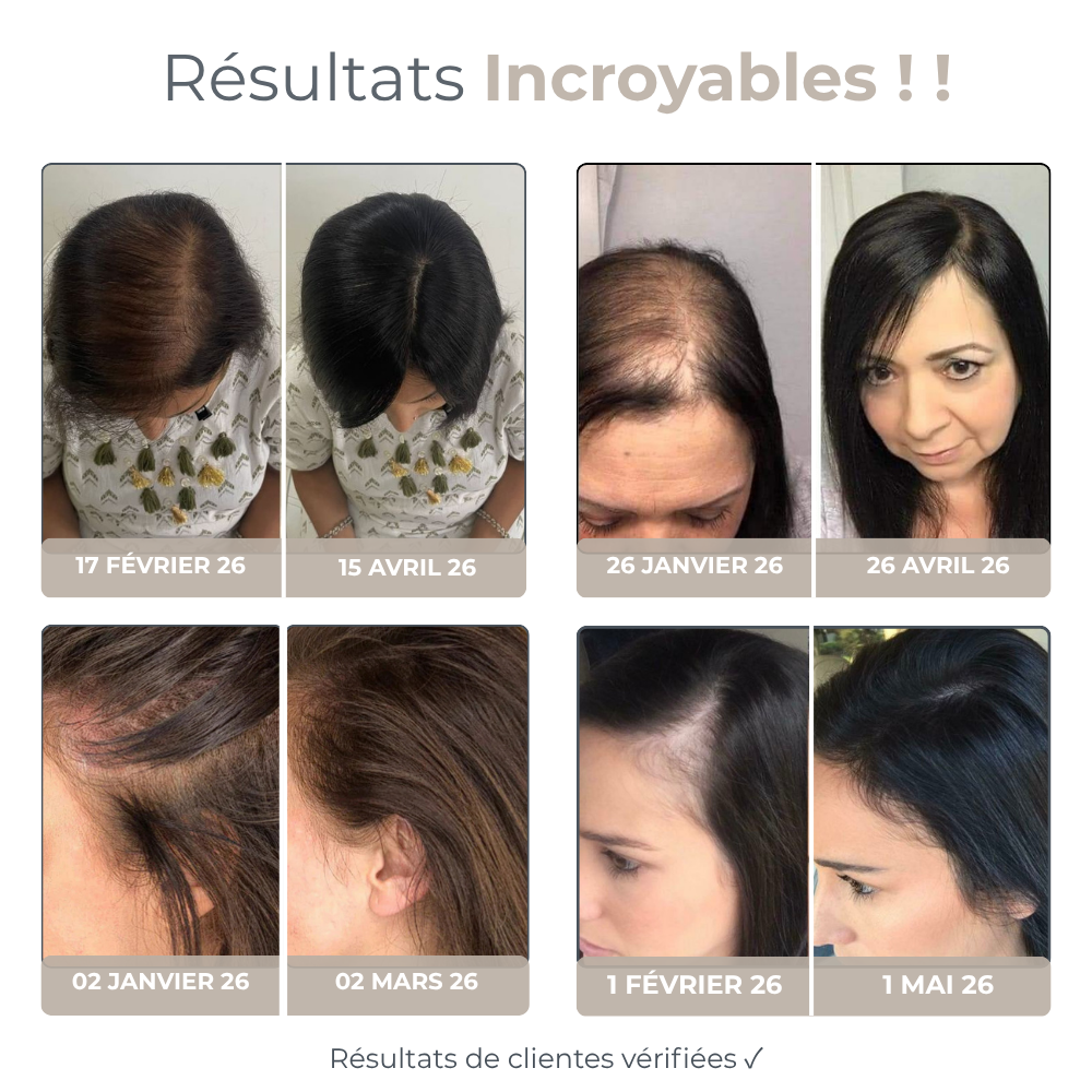 Micro Infusion Réparation & Repousses + Sérum extra offert