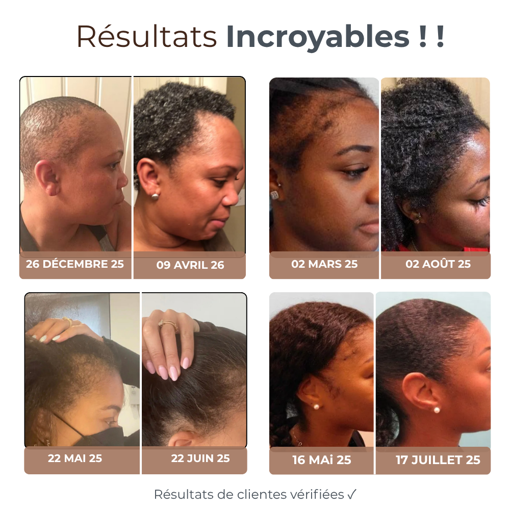 Micro Infusion Réparation & Repousses Afro  + Sérum extra offert