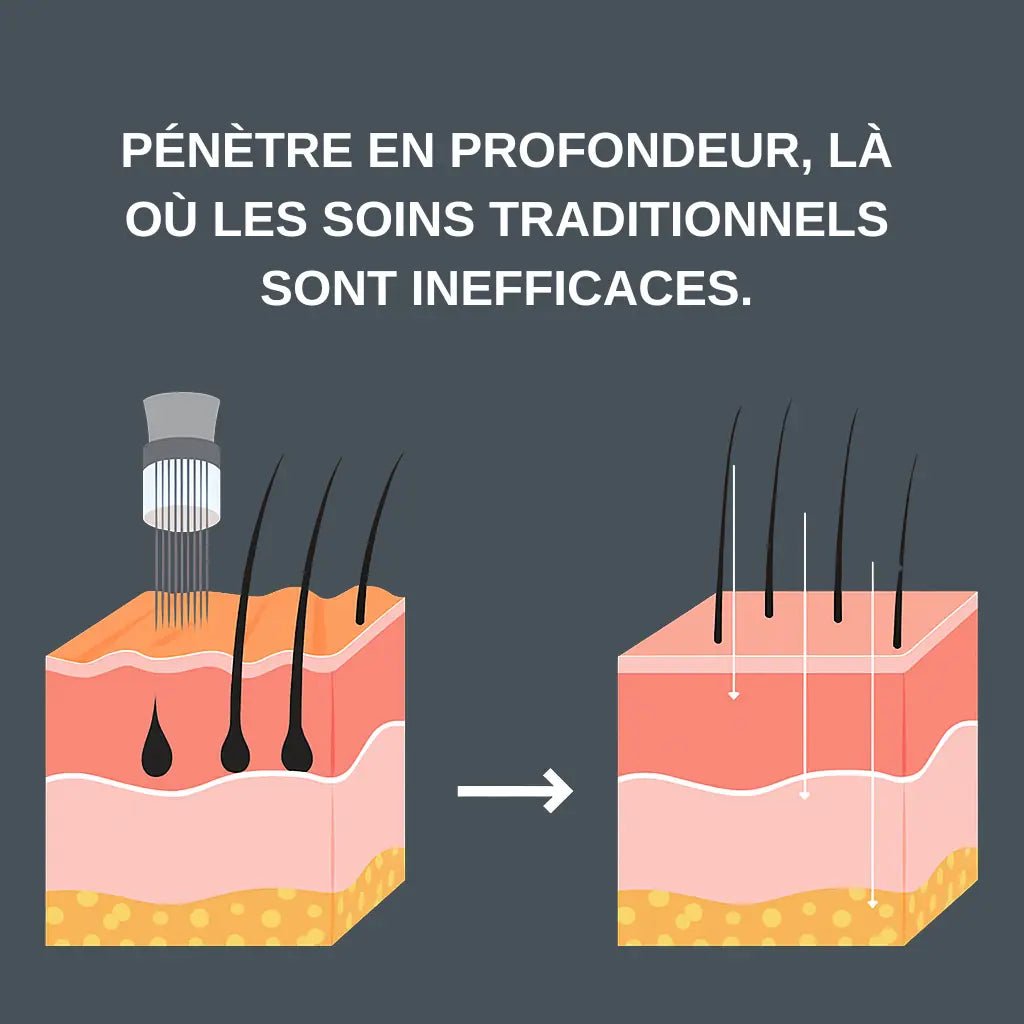 Micro Infusion Réparation & Repousses Afro + Sérum extra offert